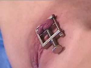 Doctor homosexual sucks at patient member