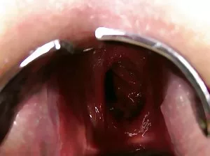 Naked babe Melanie lays on a massage table and caresses her shaved kitty