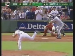 Bolnaya Calf moet mouth tolstuchy Ershikom for unittase